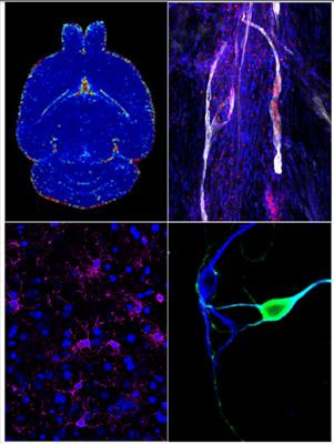 Cover image for research topic "Multifaceted interactions between immunity and the diseased brain"