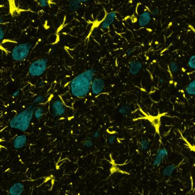 Cover image for research topic "Neuroinflammation in Traumatic Brain Injury: Friend or Foe?"