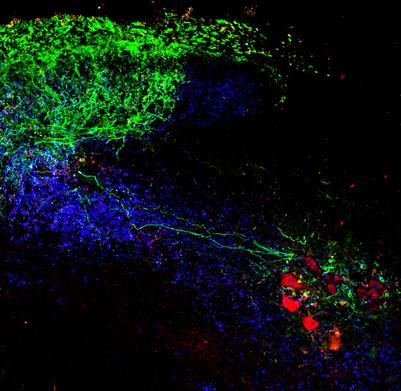 Cover image for research topic "Biochemical and Genetic Tools to Investigate the Underlying Mechanisms and Treatment of Sensorimotor Pathologies"