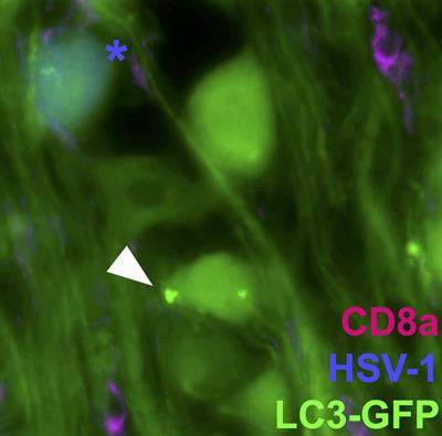 Cover image for research topic "Neuronal and Glial Alterations Caused by Viral Infections"