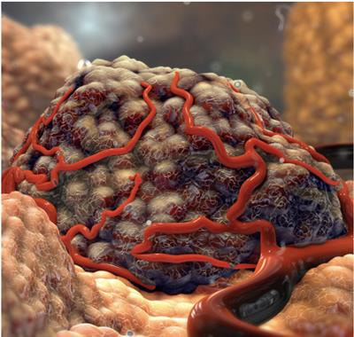 Cover image for research topic "Unveiling the Impact of Local or Systemic Therapeutic Strategies on the Tumor Microenvironment"