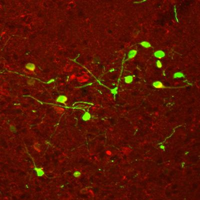 Cover image for research topic "Neuroanatomy and transgenic technologies"