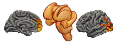 Cover image for research topic "Neuroimaging of Cognitive and Neuropsychiatric Symptoms in Movement Disorders"