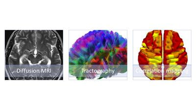 Cover image for research topic "Advances in Functional Neurosurgery"