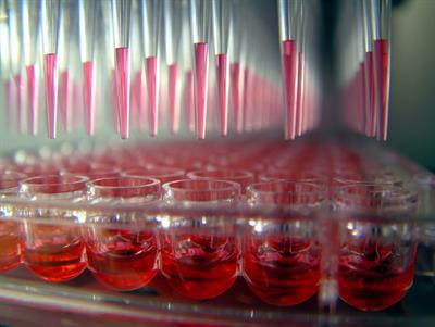Cover image for research topic "Cell-mixture deconvolution of multi-omics data in immunity: methods and applications of in silico flow-cytometry"