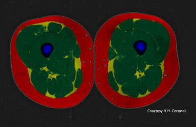 Cover image for research topic "Muscle Quality in Skeletal Muscle Function Deficit: Recent Advances and Potential Clinical and Therapeutic Implications"