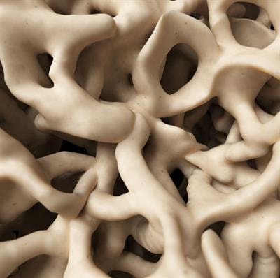 Cover image for research topic "Advances in Genetics of Skeletal Disorders"