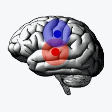 Cover image for research topic "Multimorbidity in the Context of Neurodegenerative Disorders"