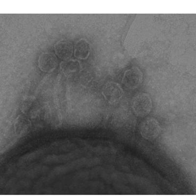 Cover image for research topic "Gram-positive phages: From isolation to application"