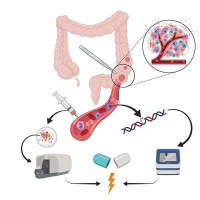 Cover image for research topic "New Insights into Colorectal Cancer Molecular Classification and Patient Stratification Strategies"
