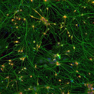 Cover image for research topic "The Next Generation of Tools and Technologies for Studying Human Neurons in a Dish"