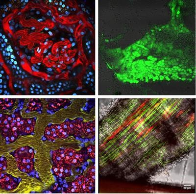 Cover image for research topic "Hypertension and Chronic Kidney Injury or Failure, Volume II"