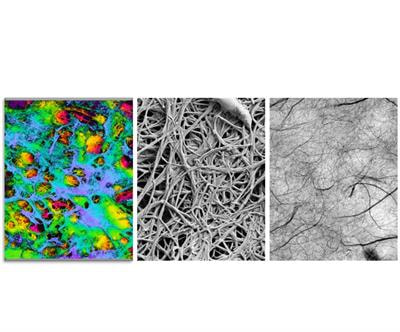 Cover image for research topic "Up to Date Developments of Nanocellulose towards Materials with Medical Benefits"
