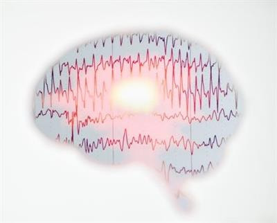 Cover image for research topic "Seizure Forecasting and Detection: Computational Models, Machine Learning, and Translation into Devices"