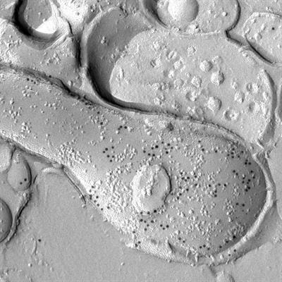 Cover image for research topic "Immunoelectron Microscopy: Placing Molecular Functions Within a Neuronal Context"