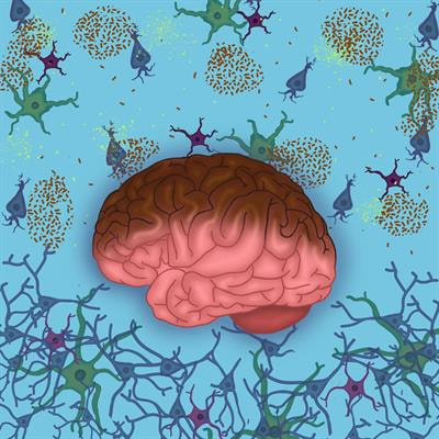 Cover image for research topic "Molecular Mechanisms of Alzheimer’s Disease: From Top to Bottom"