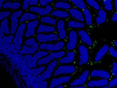Cover image for research topic "The Microbiome in Hepatobiliary and Intestinal Disease"