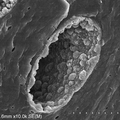 Cover image for research topic "Vascular Endothelial Glycocalyx in Cardiovascular Disease"