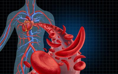 Cover image for research topic "Sickle Cell Disease in the 21st Century - From Morbidity to Molecular Biology"