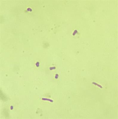 Cover image for research topic "Gram-Negative Pathogenesis"