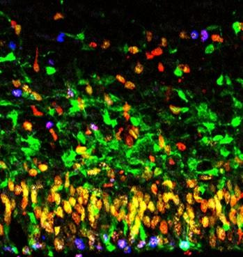 Cover image for research topic "Transcription and Chromatin Regulators in Neurodevelopmental Disorders"
