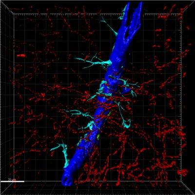 Cover image for research topic "The Neurovascular Unit as a Potential Biomarker and Therapeutic Target in Cerebrovascular Disease"