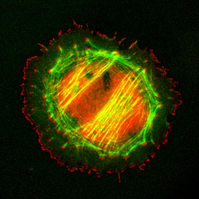 Cover image for research topic "Podocyte Pathology and Nephropathy"