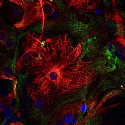Cover image for research topic "The Gut-Brain Axis – Opportunities for a Novel Approach Against Neurodegeneration"