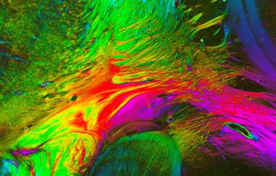 Cover image for research topic "The Human Brain Multiscale Imaging Challenge"