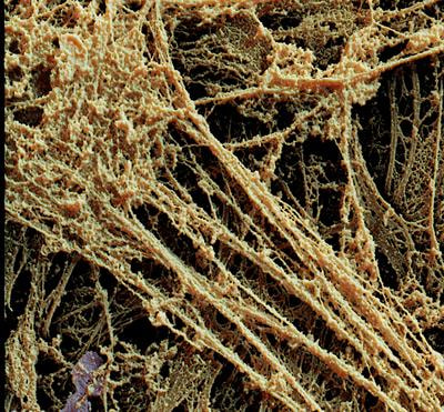 Cover image for research topic "Extracellular matrix in homeostasis and cancer"