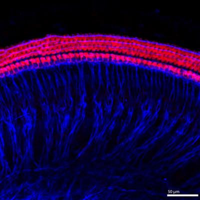 Cover image for research topic "Ototoxic Hearing Loss and Balance Disorders: Challenges and Treatment"