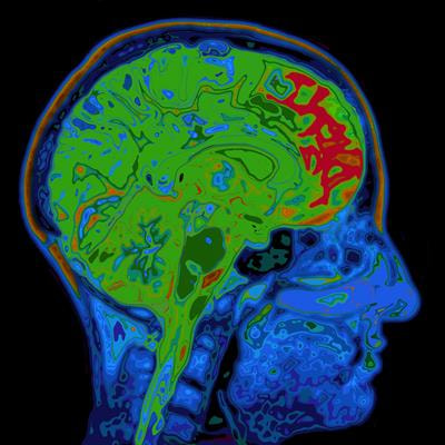 Cover image for research topic "Cerebrovasculature in Health and Diseases"