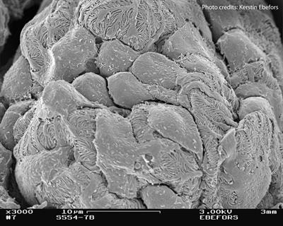 Cover image for research topic "Molecular Mechanisms of Proteinuria, Volume II"