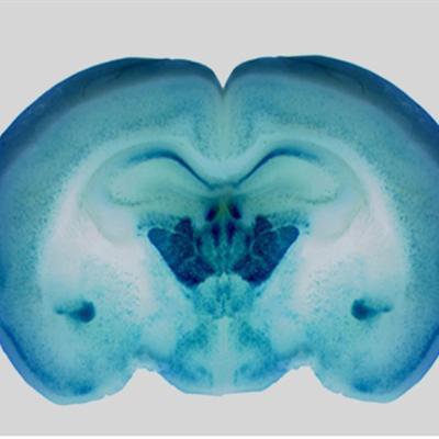 Cover image for research topic "Thyroid Hormone in Brain and Brain Cells"