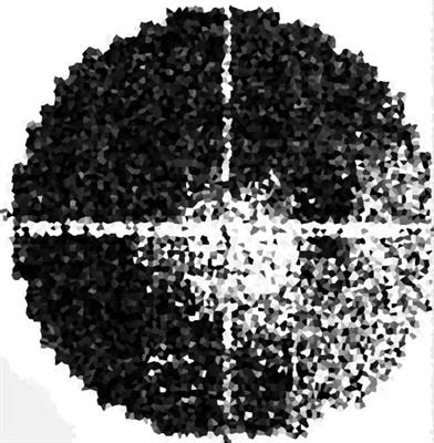 Cover image for research topic "Glaucoma and Brain: Impact of Neurodegeneration on Visual Abilities and Related Biomarkers."