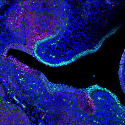 Cover image for research topic "Dynamics of the Epithelium During Organ Development & Regeneration"