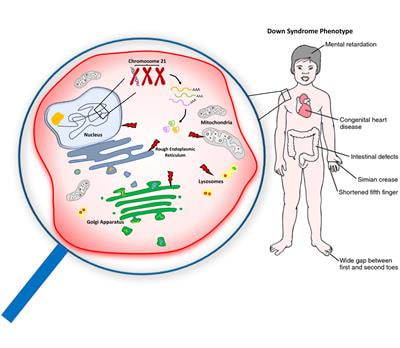 Cover image for research topic "Gene expression, Molecular Pathways and Organelle Alterations in Down syndrome Phenotype."