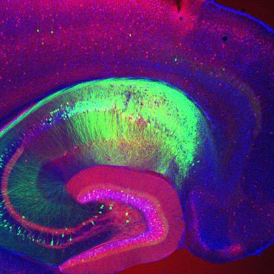 Cover image for research topic "Molecular Mechanisms for Reprogramming Hippocampal Development and Function by Early-Life Stress"