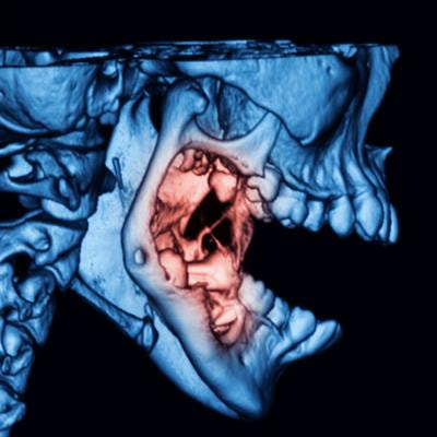 Cover image for research topic "Odontogenic Tumors"
