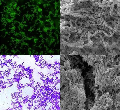 Cover image for research topic "Streptococcus spp. and Corynebacterium spp.: Clinical and Zoonotic Epidemiology, Virulence Potential, Antimicrobial Resistance and Genomic Trends and Approaches"