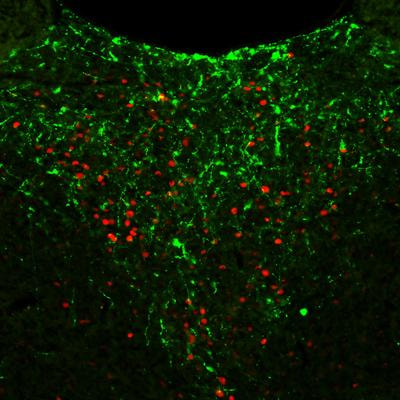 Cover image for research topic "Recent advances in understanding the functions and roles of the midline and intralaminar thalamus"