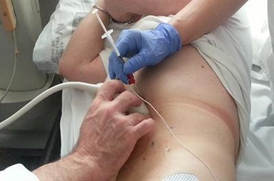 Cover image for research topic "Botox in Complex Abdominal Wall Surgery"