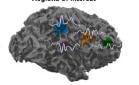 Cover image for research topic "Functional Neuroimaging, Neuromodulation and Neurofeedback: New Frontiers in Seizure Disorders"