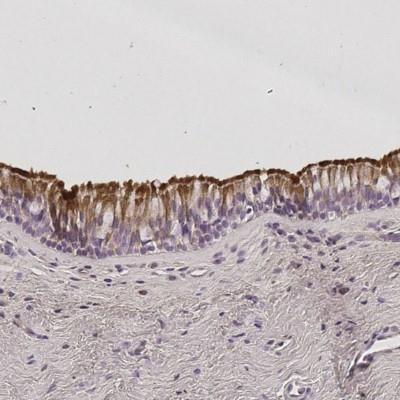 Cover image for research topic "Basic Mechanisms of Inflammatory Upper Airway Disease"