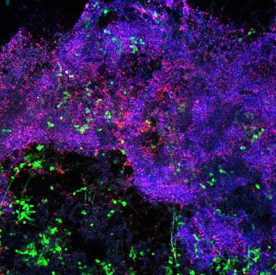 Cover image for research topic "Polymicrobial-Host Interactions in Oral Diseases"