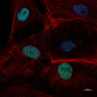 Cover image for research topic "Epigenetic Regulation of Inflammatory Pathways in Cancer and Aging"