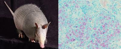 Cover image for research topic "Reservoirs for Mycobacterium leprae in the Environment"