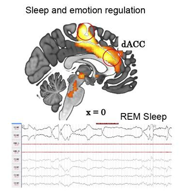 Cover image for research topic "How Does Sleep Help Regulate Negative Emotion?"