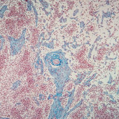 Cover image for research topic "Systems Analysis of Tissue Resident Immune Cells"