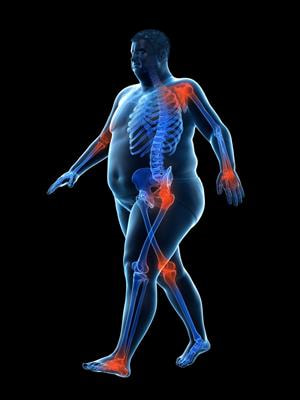 Cover image for research topic "Endocrine Adaptations Associated with Obesity: The
Crosstalk Amongst Skeletal Muscle, Adipose tissue and Bone"